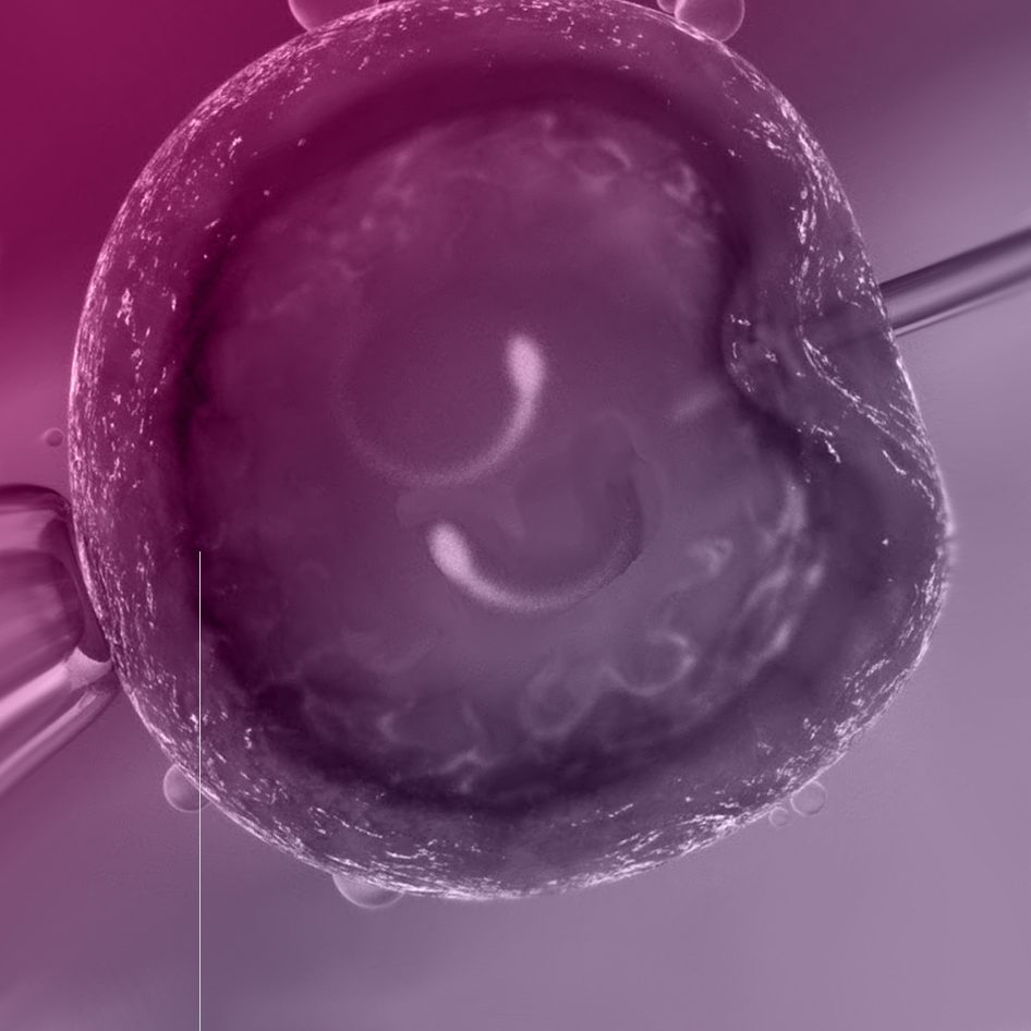 Injeção Intracitoplasmática dos espermatozoides (ICSI)