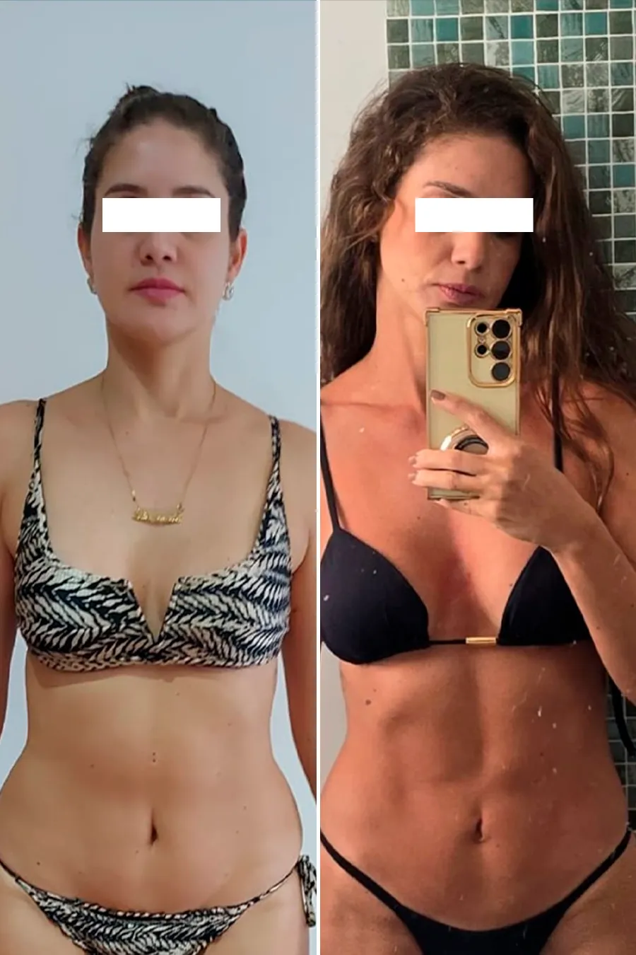 Registro comparativo individual de antes e depois, caso 1, reproduzido da LP da clínica